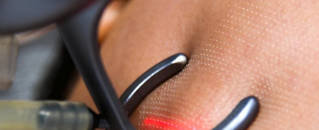 Collagène : bienfaits réels, sources et supplémentation