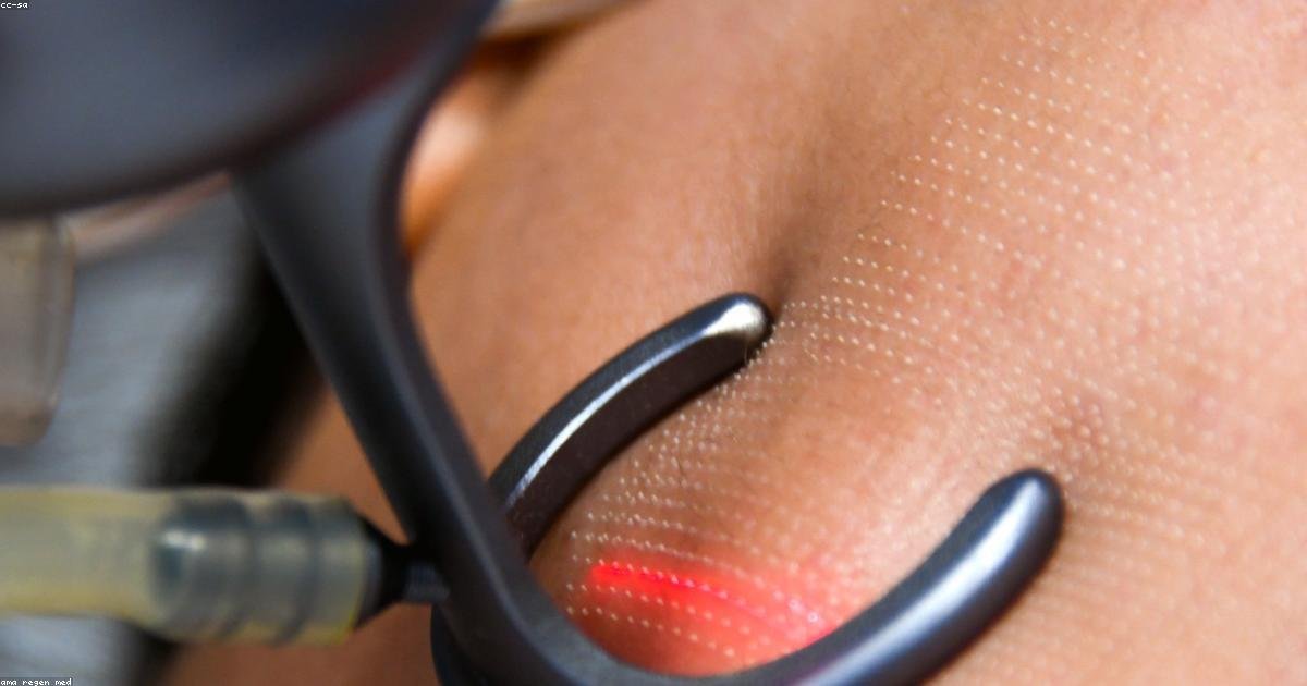 Collagène : bienfaits réels, sources et supplémentation