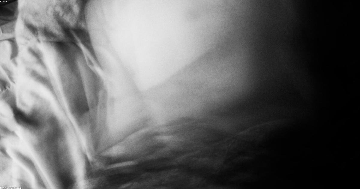 Nuit blanche : comment récupérer rapidement après une nuit sans dormir